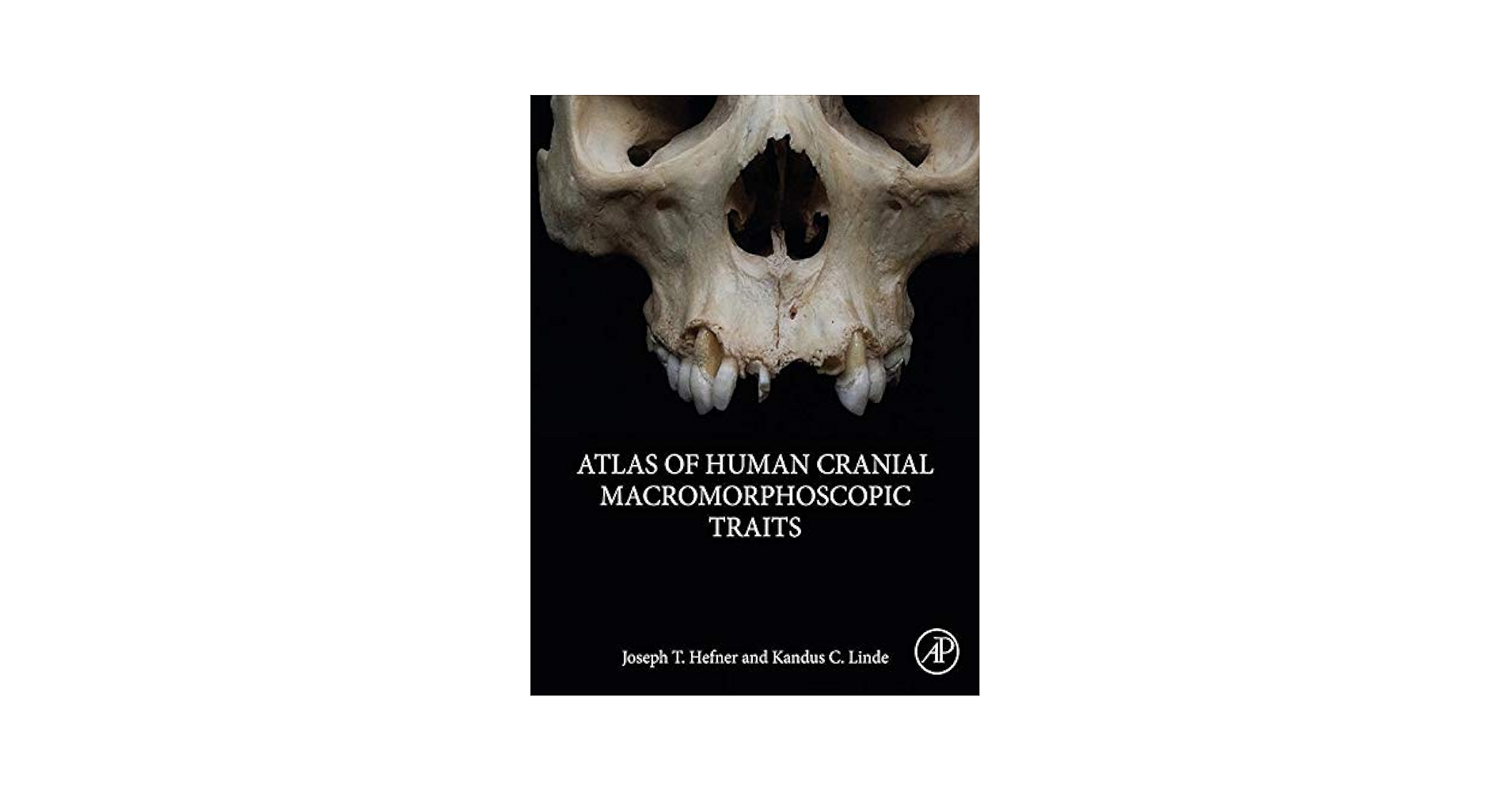 Amazon.com: Atlas of Human Cranial Macromorphoscopic Traits
